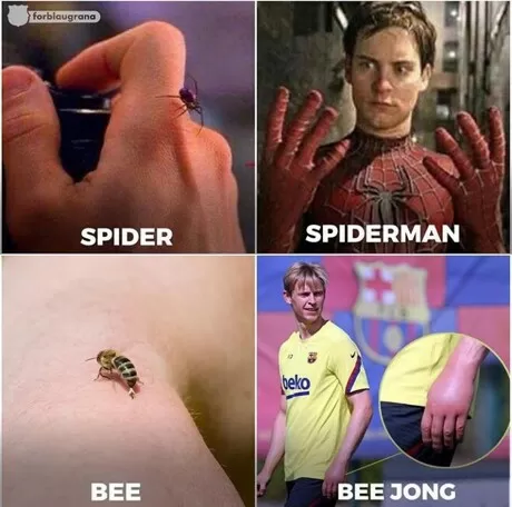 De Jong Shows Off Nasty Bee Sting Which Has Seen His Left Hand Balloon In Size All Football