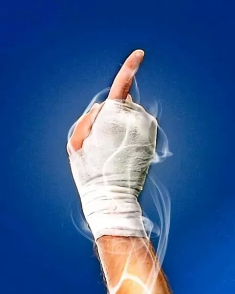 in his hands' - referring to benzema's bandaged