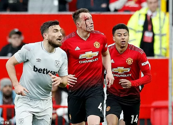 Phil Jones Suffers Nasty Injury With Blood Pouring From His Head All Football