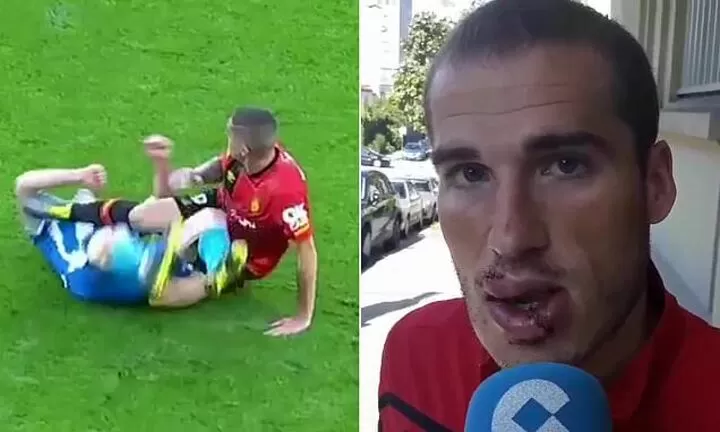 Spanish Player Needs 70 Stitches After Accidentally Kicked Him In