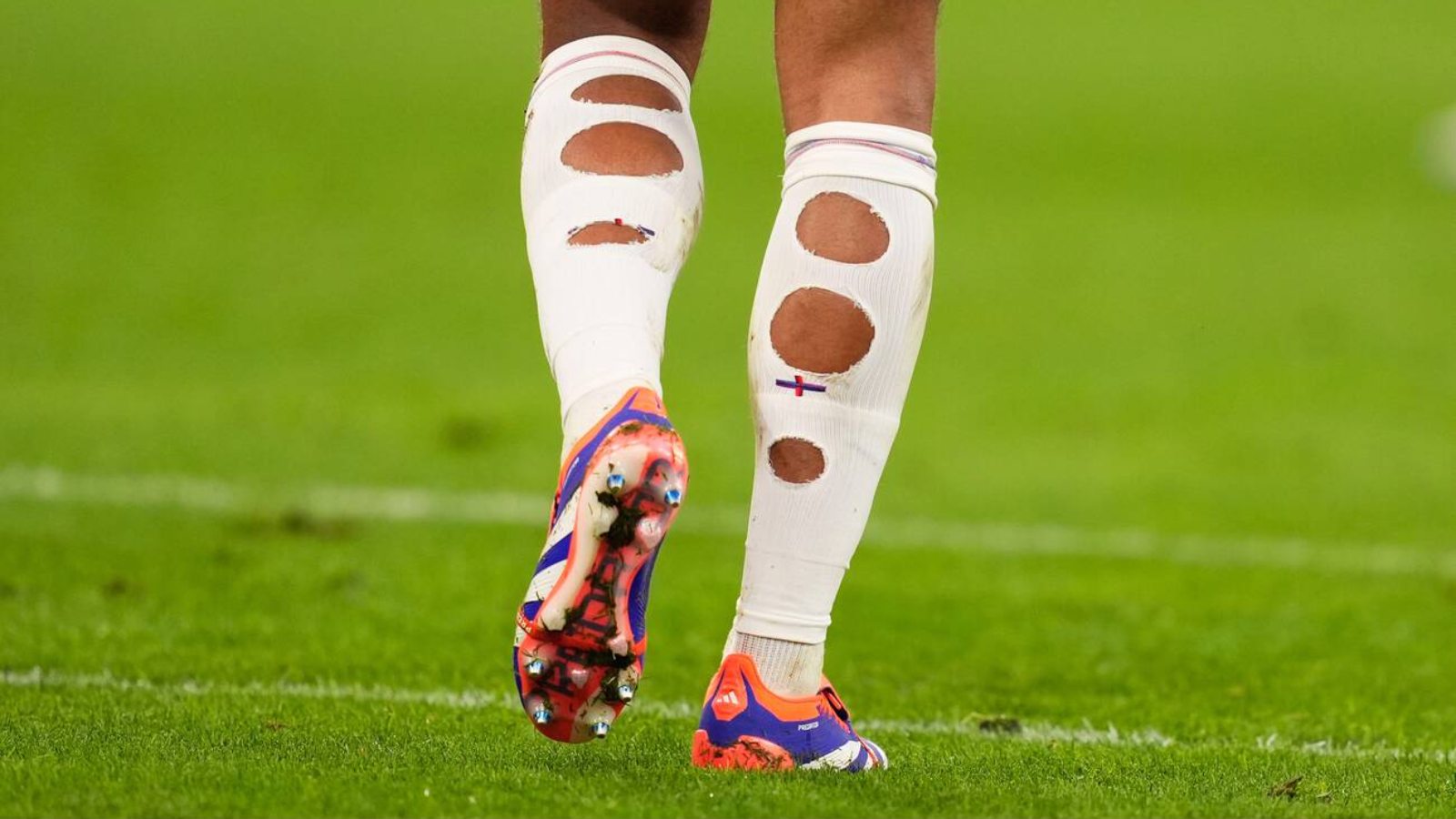A deep dive into the ‘holes in football socks’ phenomenon All Football