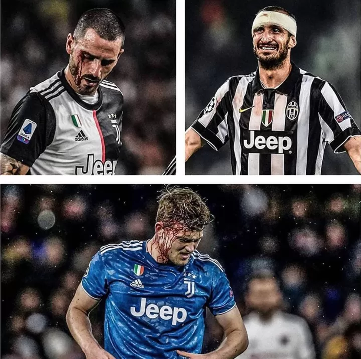 Soldiering On With Blood Juventus Defenders Are True Warriors All Football