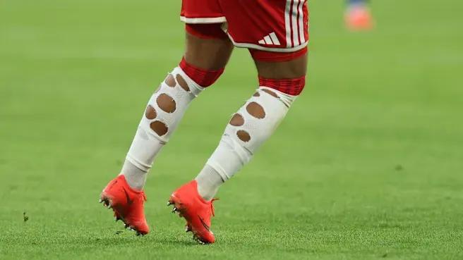 Bild: I calzettoni di Sarr avevano 12 buchi, ma non sono conformi al regolamento DFL