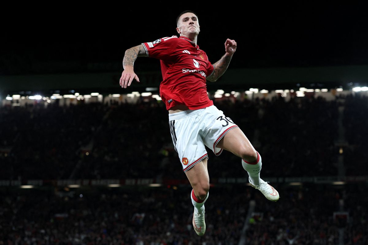 Man Utd: Sesko bỏ lỏ trận gặp Fulham ở Premier League do chấn thương xương chày