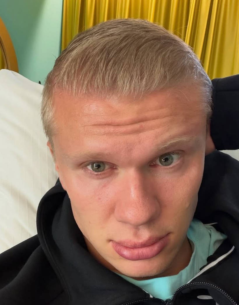 Ele manterá o cabelo curto? Haaland posta selfie do primeiro corte de cabelo desde que o aparou