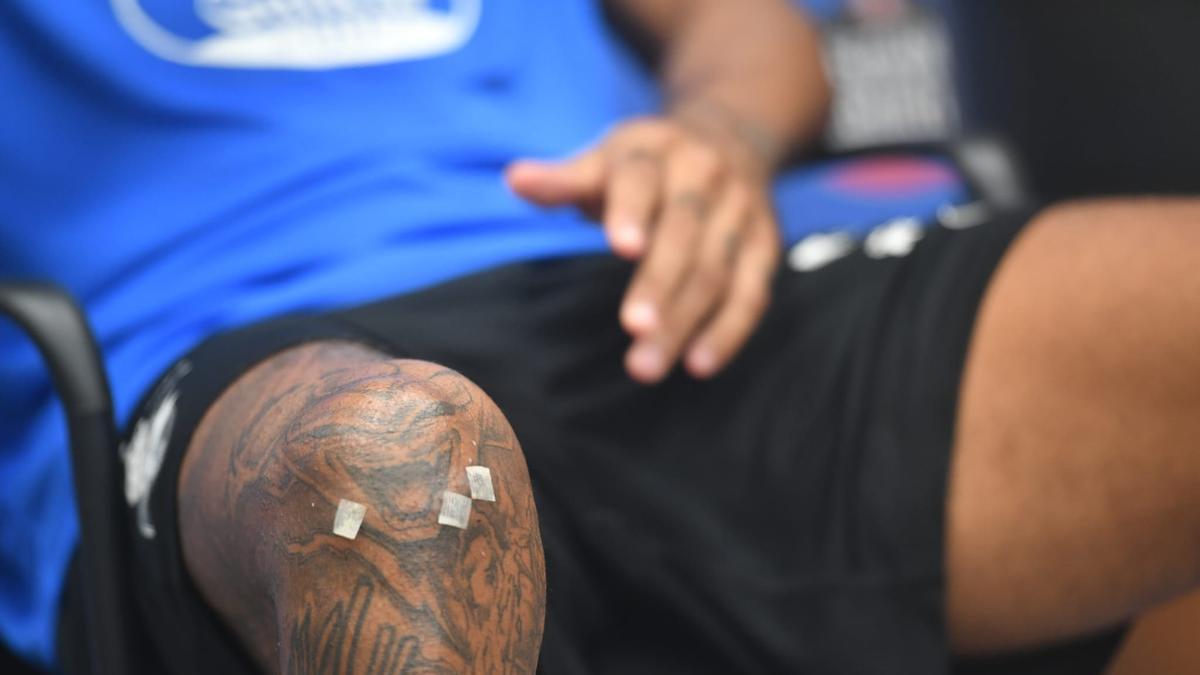 Majin-Buu-Tattoo auf Aubaméyangs Knie nach OP deutlich sichtbar